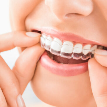 Which is Better: Invisalign or Tradational Braces?